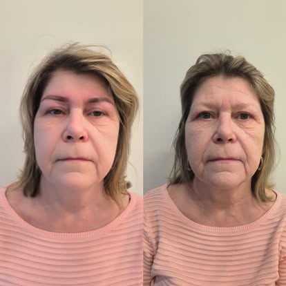 Brwi przed zabiegiem i po zabiegu makijażu permanentnego